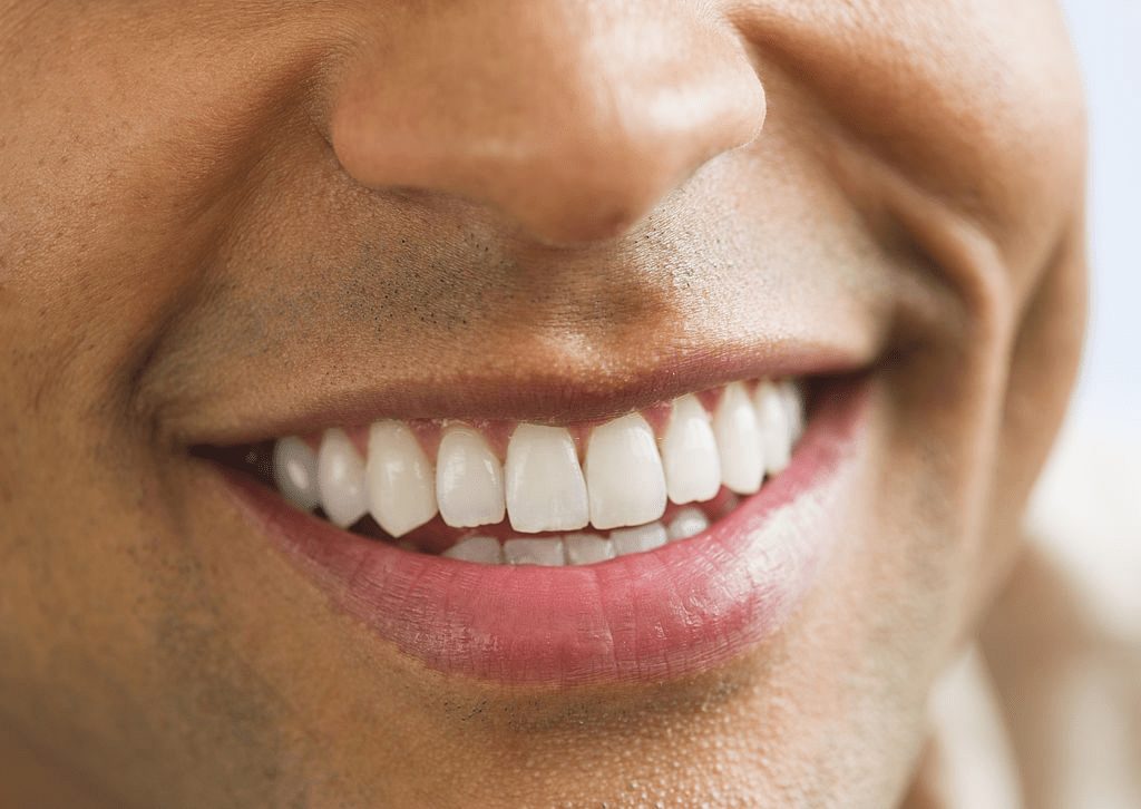man smiling with up close of white straight teeth